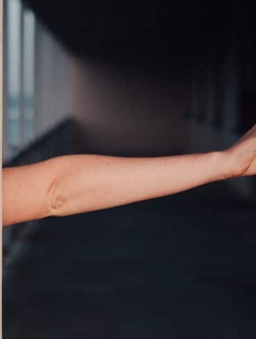 Bien protéger ses bras en trottinette